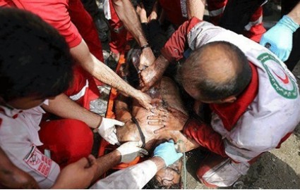 سقوط تخته سنگ 3 تنی بر روی اندام تحتانی یک مرد در معدن سنگ اصفهان